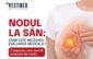 nodul sân